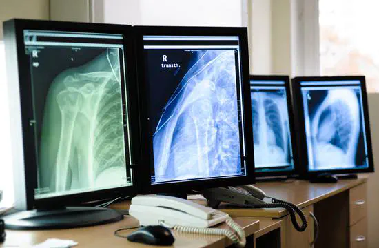 Procesado y tratamiento de la imagen en radiología convencional